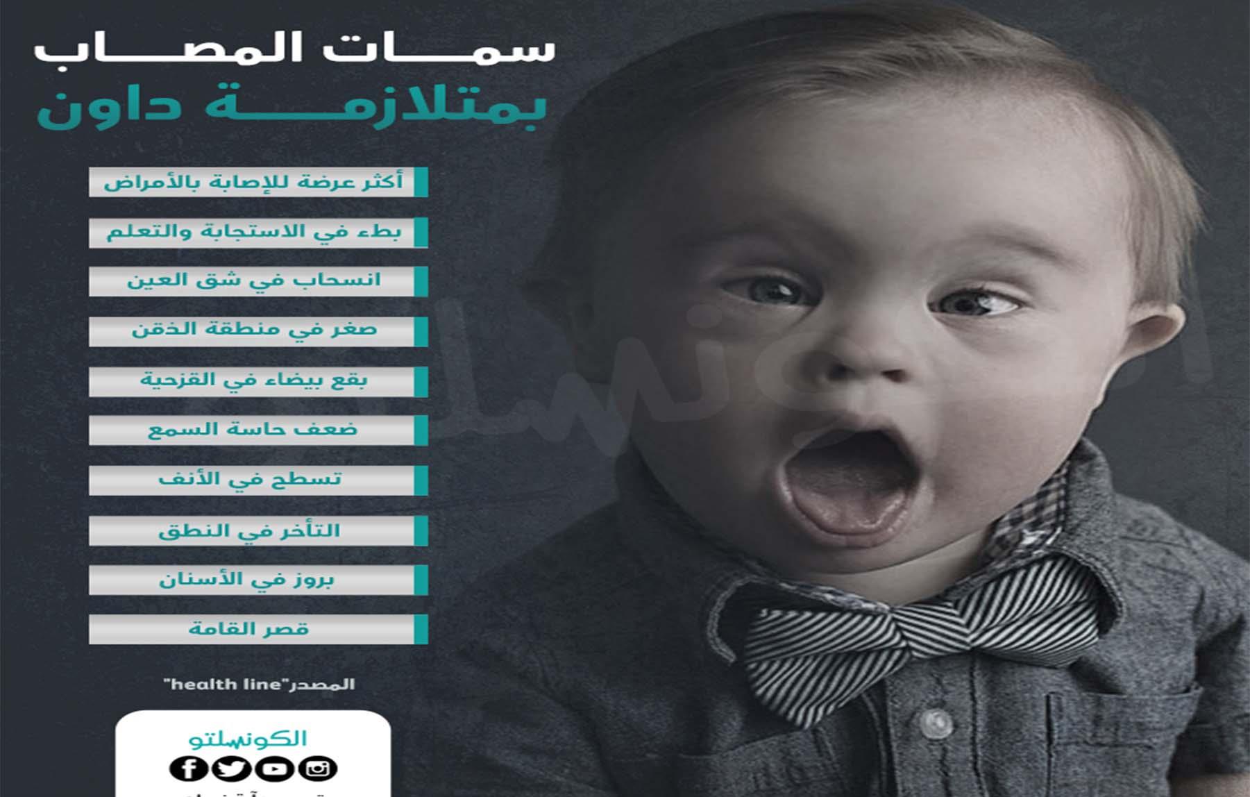 123-Recovered-Recovered-Recovered_0004_سمات-المصاب-بمتلازمة-داون