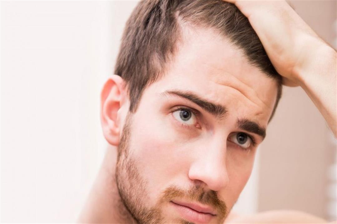 أغربها الكركديه.. 7 علاجات بديلة لتساقط الشعر عند الرجال (صور)