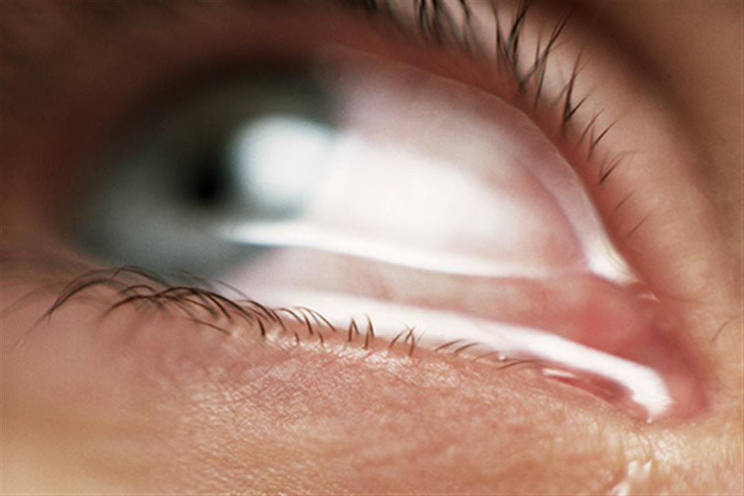 ليست دليلًا على الحزن فقط.. 7 أمراض تكشف عنها دموع العين