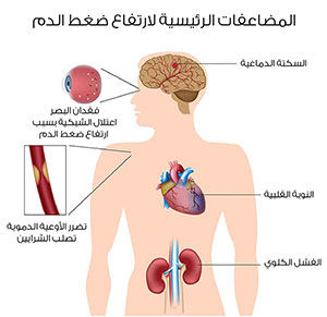 مضاعفات ارتفاع ضغط الدم