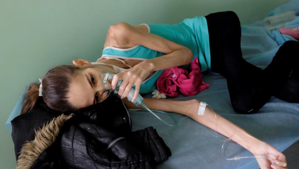 مريضة بالإيدز والسل ترقد على نقالة في مستشفى بفنزويلا (رويترز)