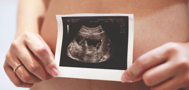 إفرازات وردية بداية الحمل