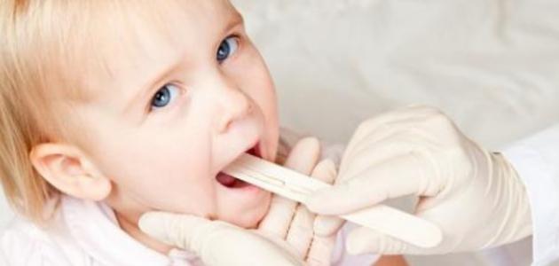 علاج التهاب الحلق عند الاطفال