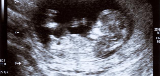 علامات الحمل في الأسبوع الأول للبكر