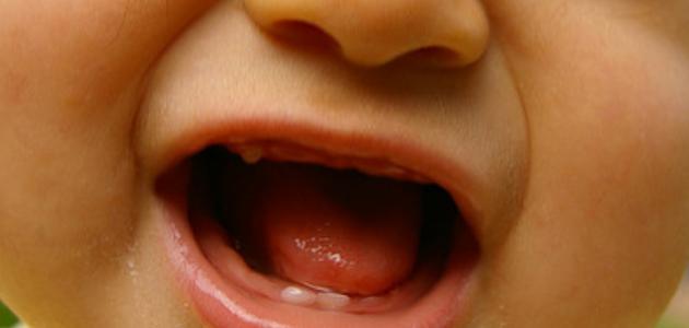 ما هى اعراض ظهور الاسنان عند الاطفال