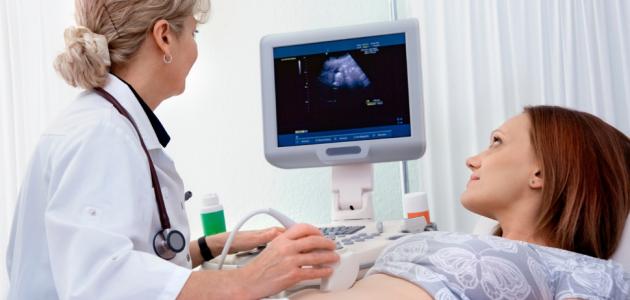 معرفة نوع الجنين في الشهر الأول من الحمل