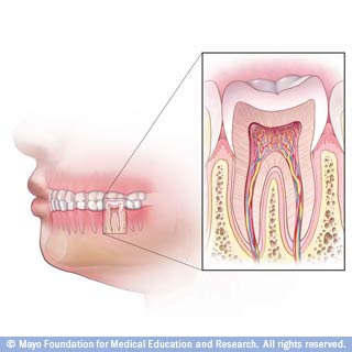 نظرة عامة على علاج جذور الاسنان