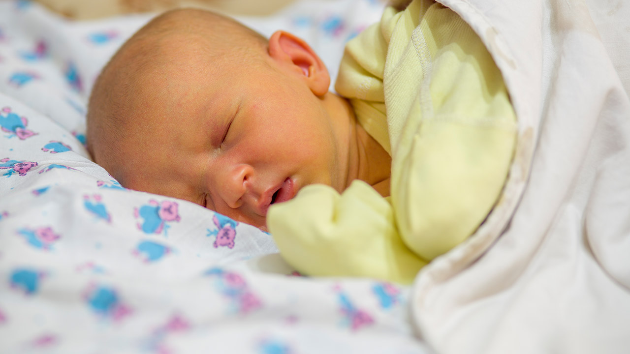 Image result for jaundice in newborn