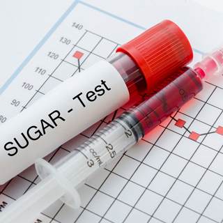 الكشف عن السكري من النوع الثاني