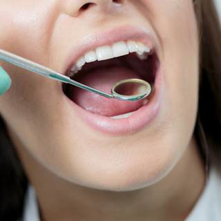 الافراط في علاج الأسنان