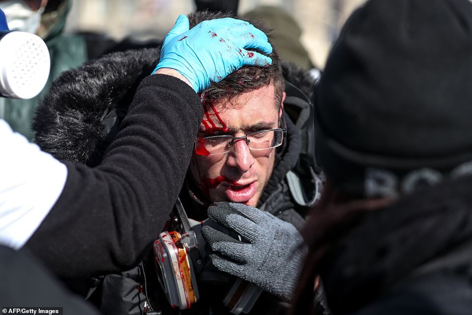 An injured protester pictured during clashes with riot forces on the Champs-Elysees today.Â Around 12 members of the Yellow Vest movement have died at blockades organised at major roads around France, while hundreds of others have been injured in rioting