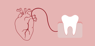 علاقة صحة الاسنان واللثة بأمراض القلب