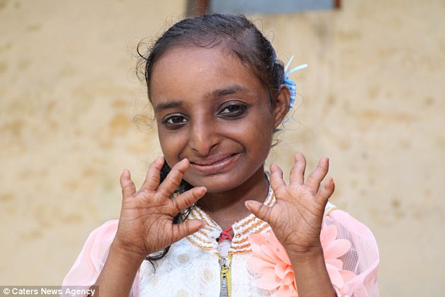 At 2ft 9in inches, Mandeep is the shortest person the villagers have ever seen. She is just an inch taller than a cricket bat and her palm and feet match that of a two-year-old