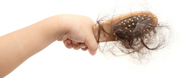 ما هي أسباب تساقط الشعر عند الأطفال؟