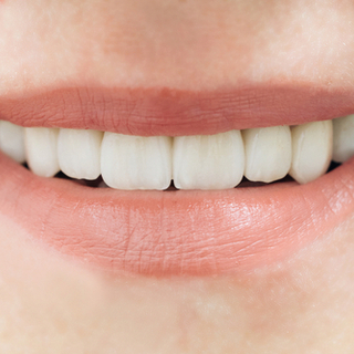 أهمية تركيب الأسنان الاصطناعية
