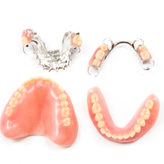 أنواع تركيب الأسنان الاصطناعية