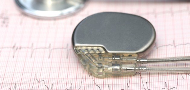 متى يحتاج المريض لزراعة جهاز تنظيم ضربات القلب؟