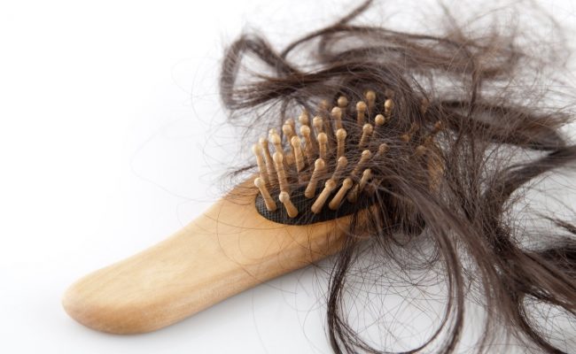 علاج تساقط الشعر الهرموني