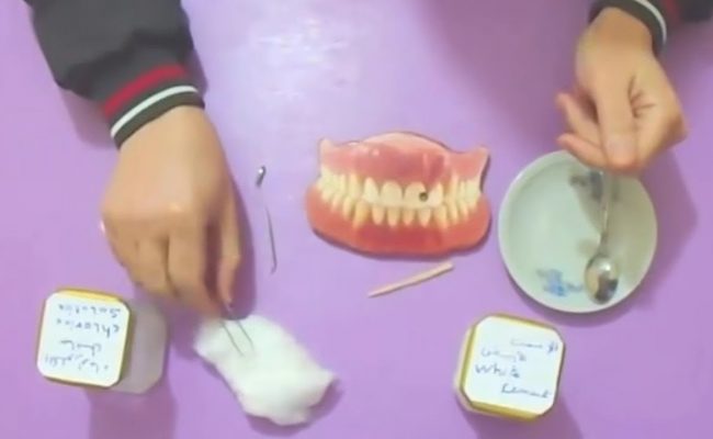 حشوة أسنان تباع في الصيدلية النهدي 